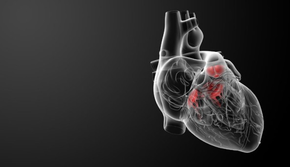 Beating Heart Aortic Valve Replacement by OrangeCountySurgeons